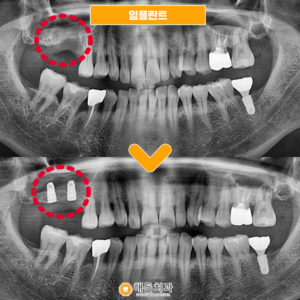 20250919수정캡쳐본