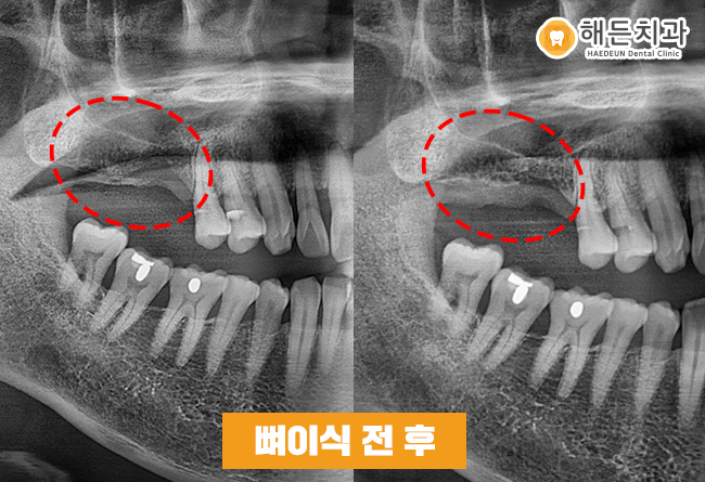 천안아산치과