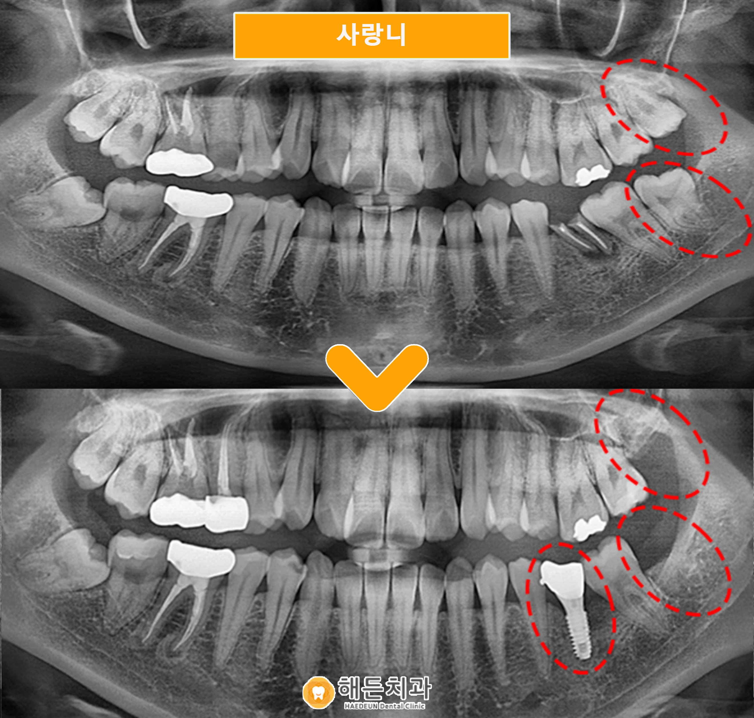 천안아산치과